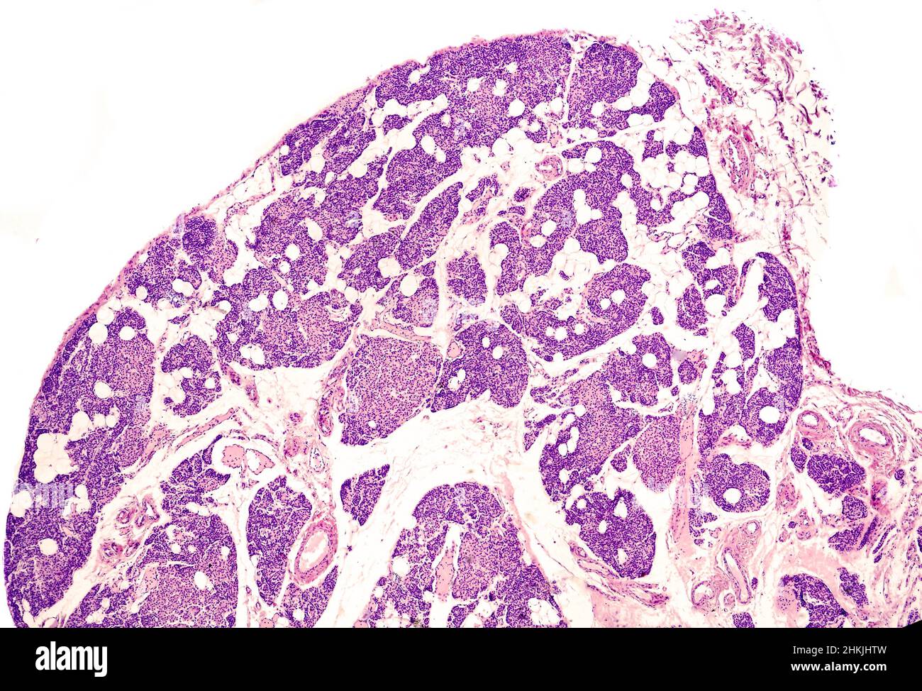 Parathyroid Micrograph Parathyroid gland, light micrograph Stock Photo - Alamy