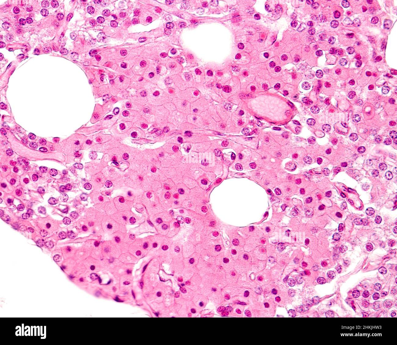 Parathyroid Micrograph Parathyroid gland, light micrograph Stock Photo - Alamy