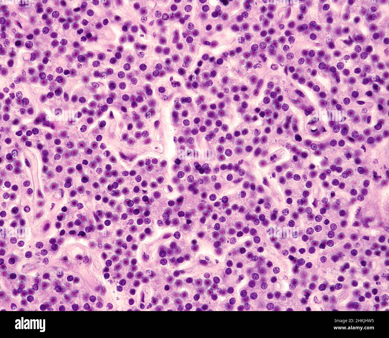 Parathyroid Micrograph Parathyroid gland of a child, light micrograph Stock Photo - Alamy