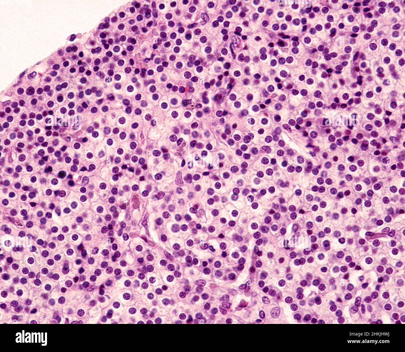 Parathyroid Micrograph Parathyroid gland of a child, light micrograph Stock Photo - Alamy
