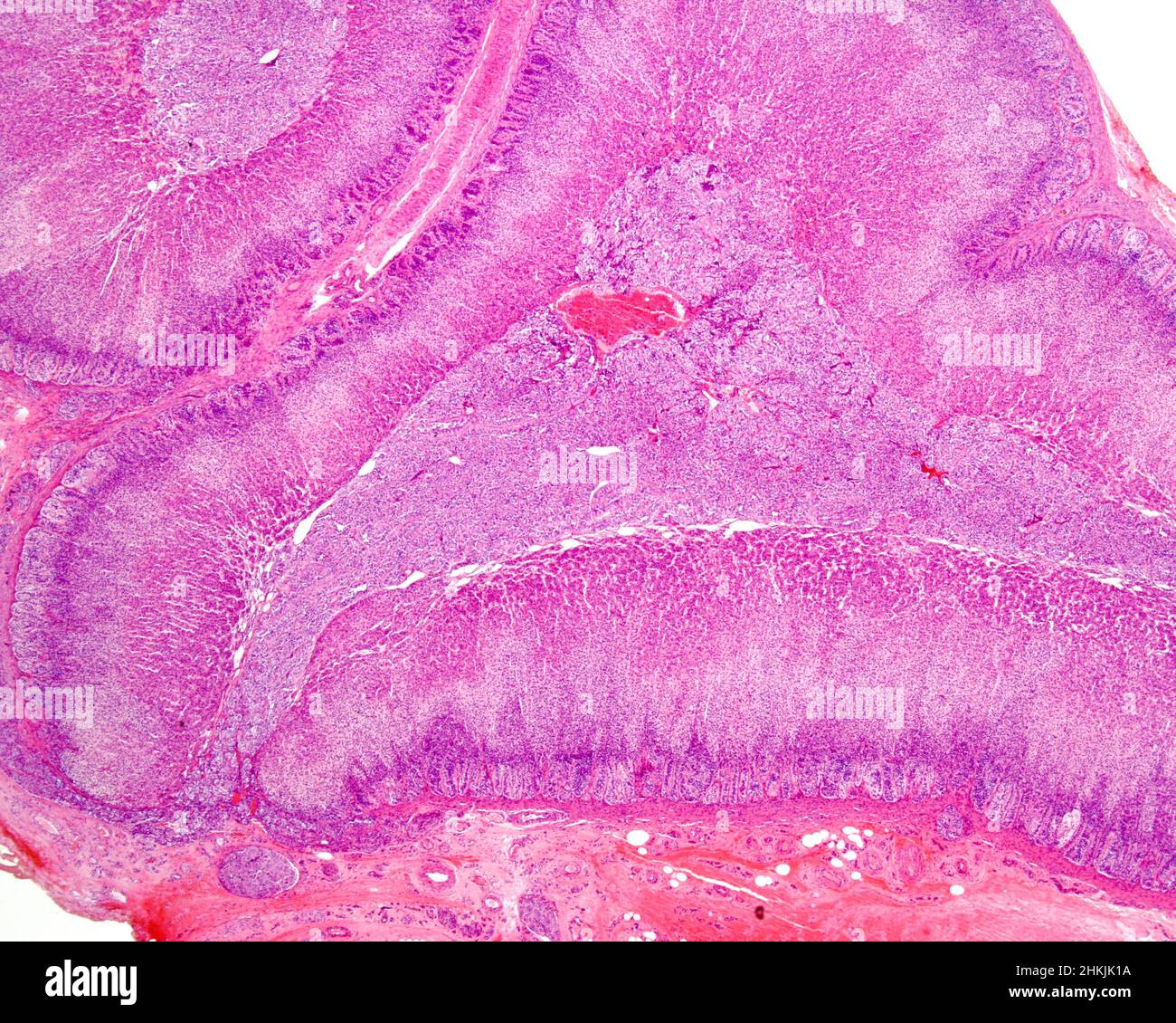 Human adrenal gland cortex and medulla, light micrograph Stock Photo ... Biology Diagrams