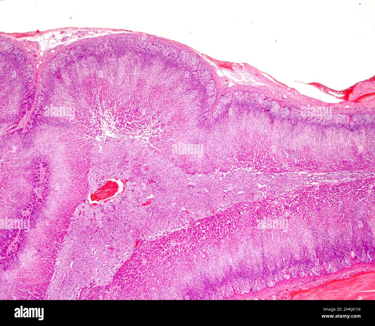 Human adrenal gland cortex and medulla, light micrograph Stock Photo ...