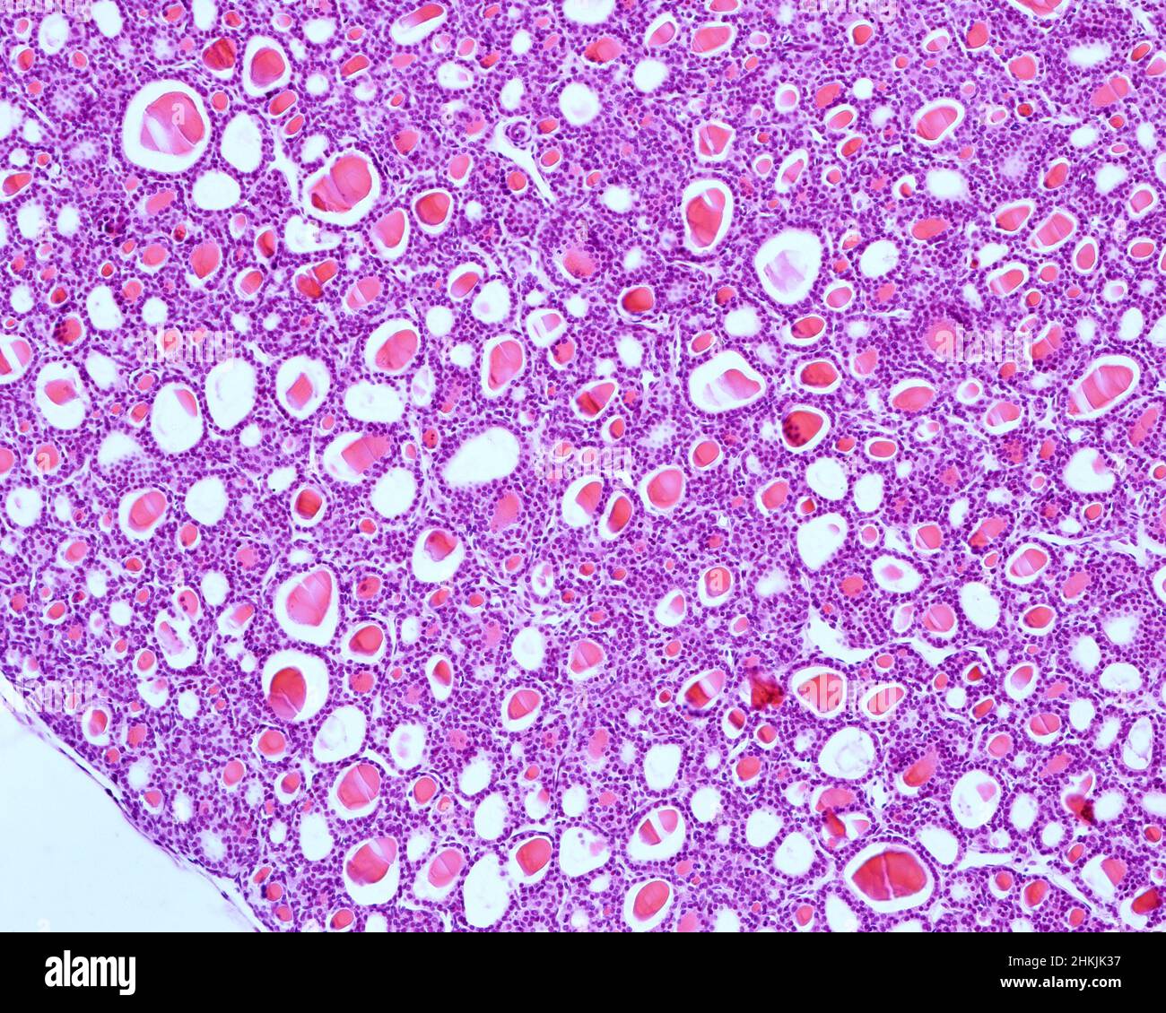 Cat thyroid gland, light micrograph Stock Photo Alamy