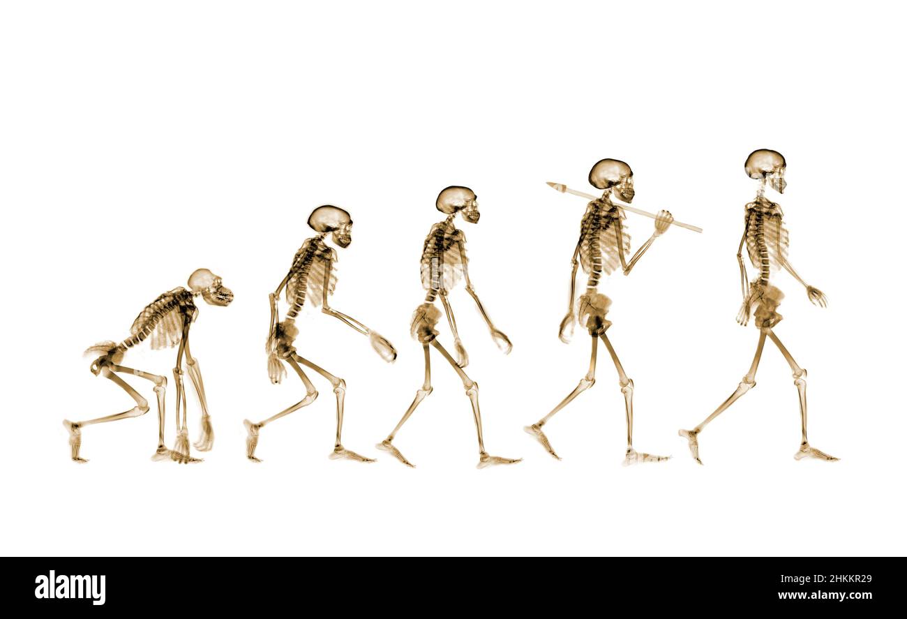 Human evolution, conceptual X-ray Stock Photo
