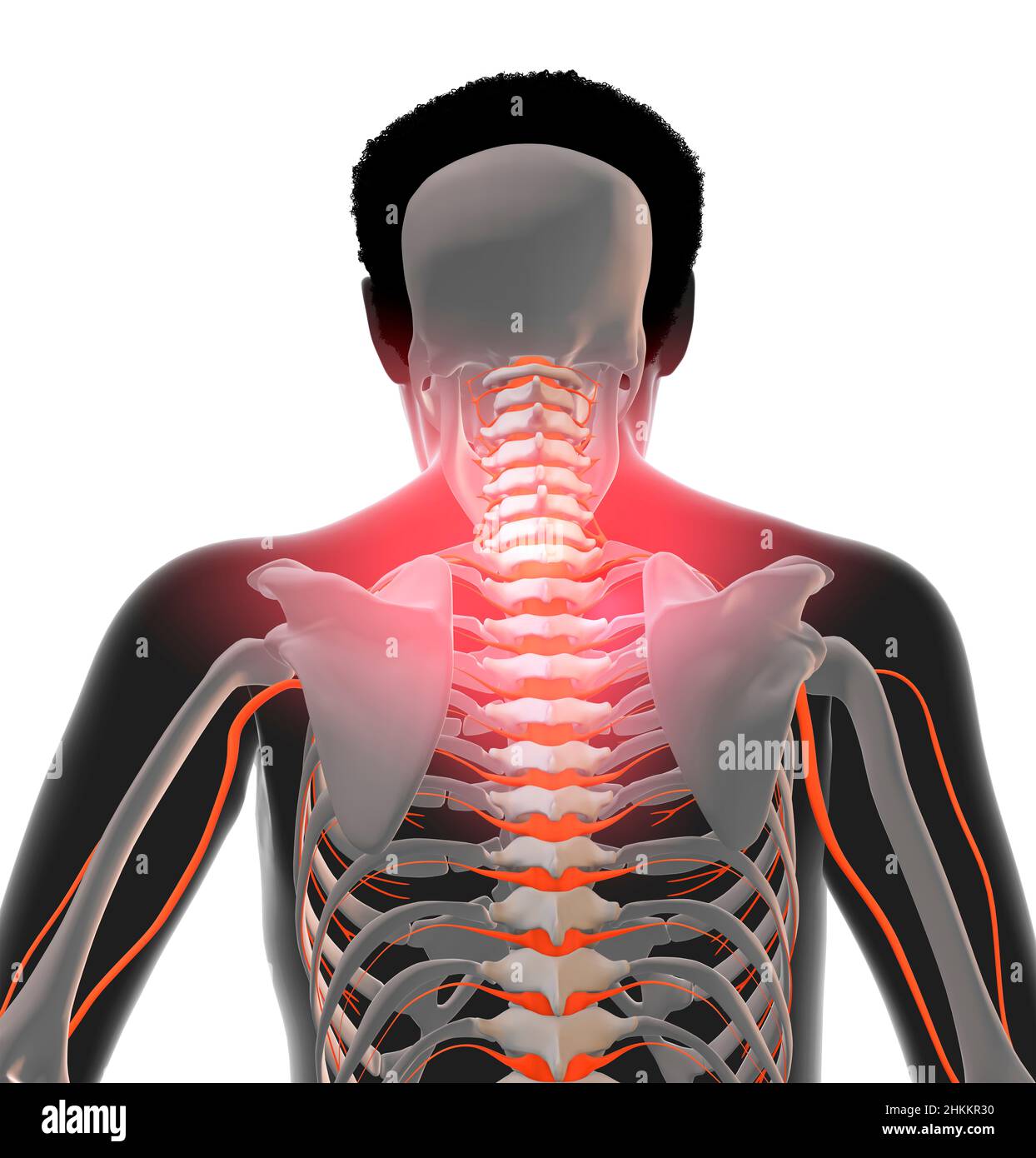 Neck and back pain, illustration Stock Photo Alamy