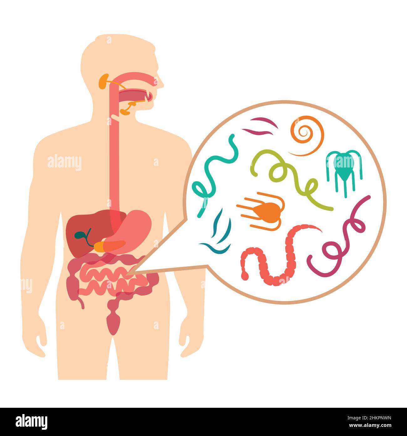 Vector Illustration of a Human Intestinal Parasites, worm disease Stock Vector