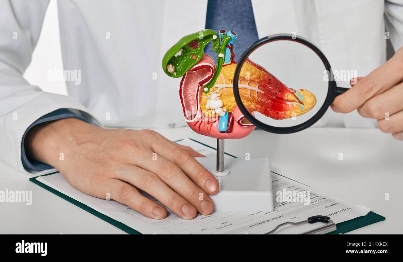 Diagnosis and treatment of pancreatic disease. doctor consulting patient with acute pancreatitis patient pointing out pancreatic disease on anatomical Stock Photo