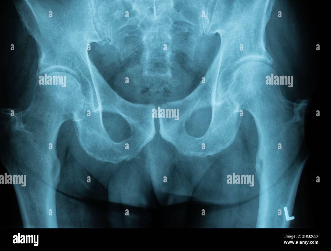 XRay Image of a Human Chest for a medical diagnosis Stock Photo Alamy