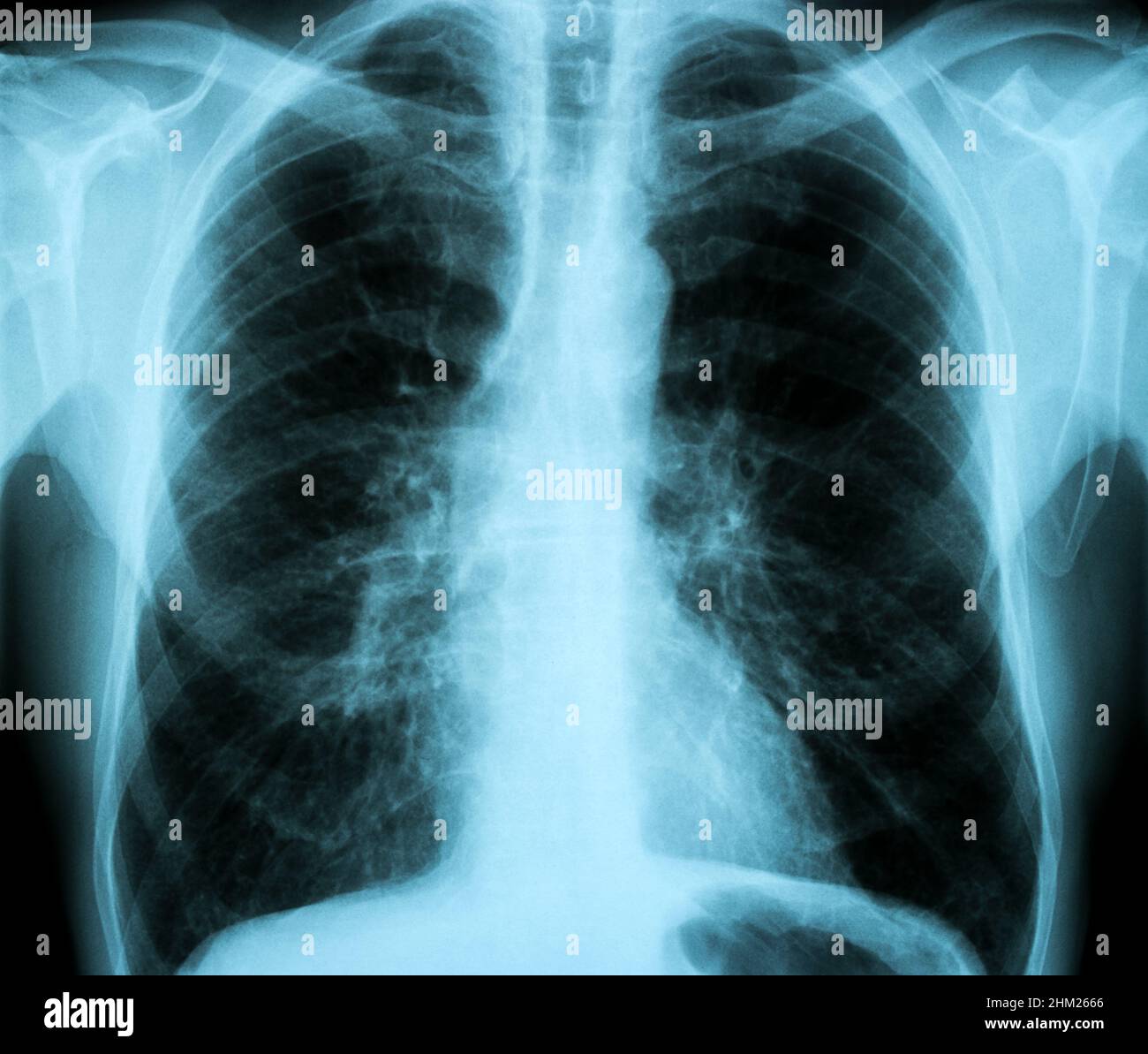 XRay Image of Human Healthy Chest MRI Stock Photo Alamy