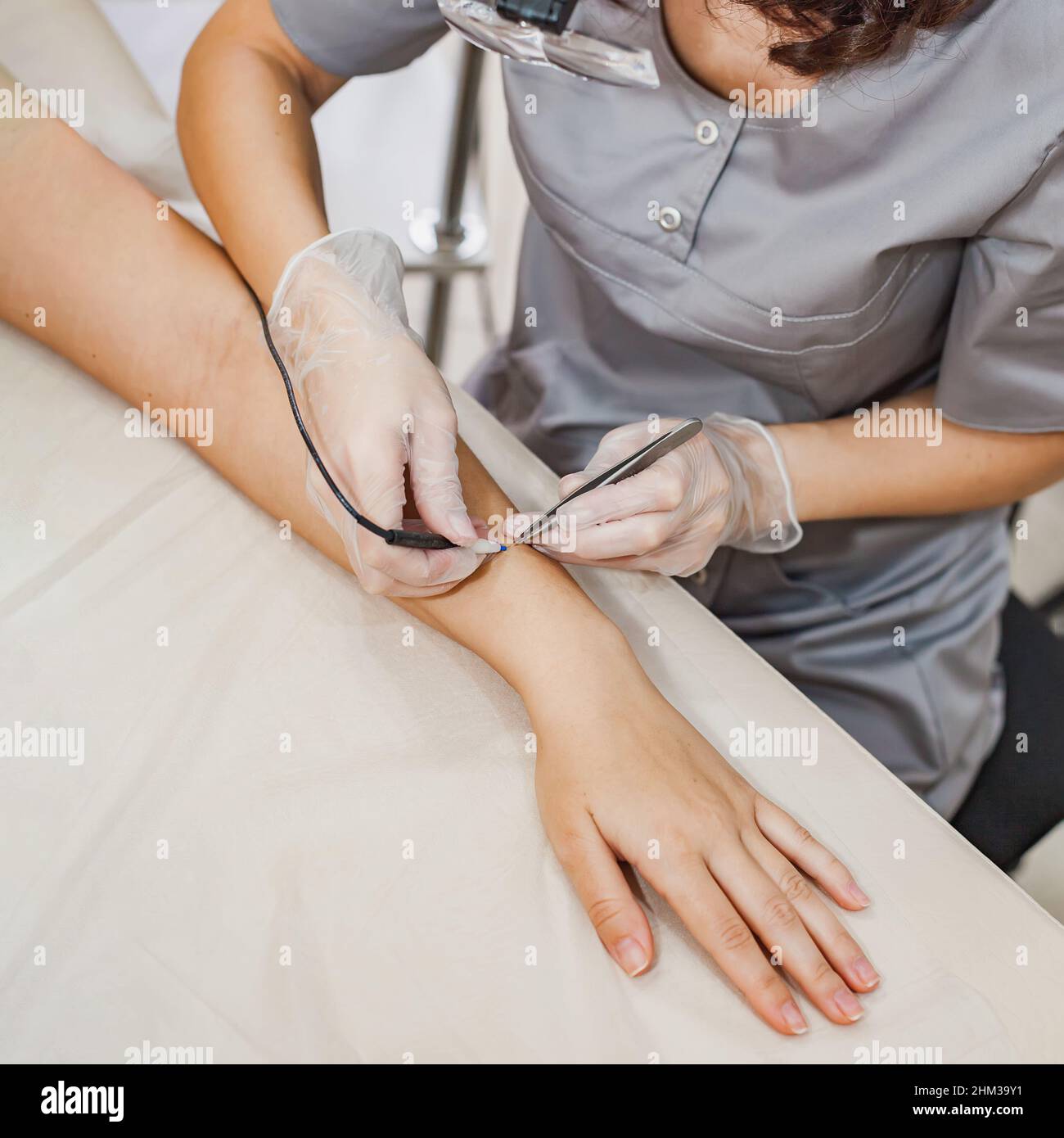 Professional electrolysis device permanent hi-res stock photography and ...