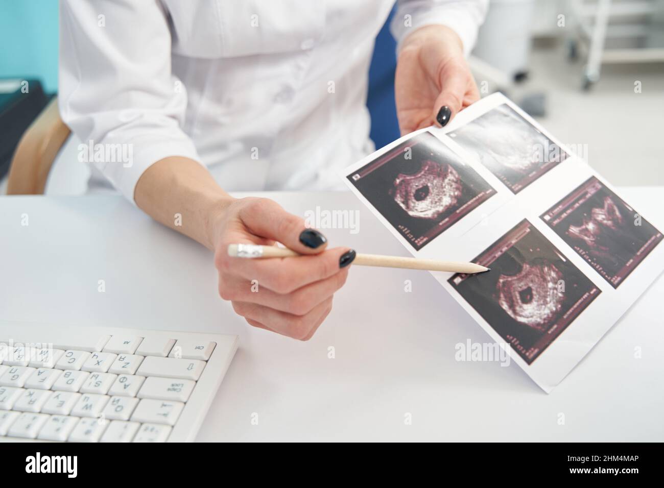 Doctor demonstrating first trimester ultrasound images of her patient Stock Photo Alamy