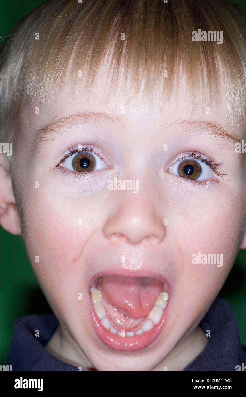 Portrait Of A Boy With His Mouth Open, Credit:Photoshot Creative / Stuart Cox / Avalon Stock Photo