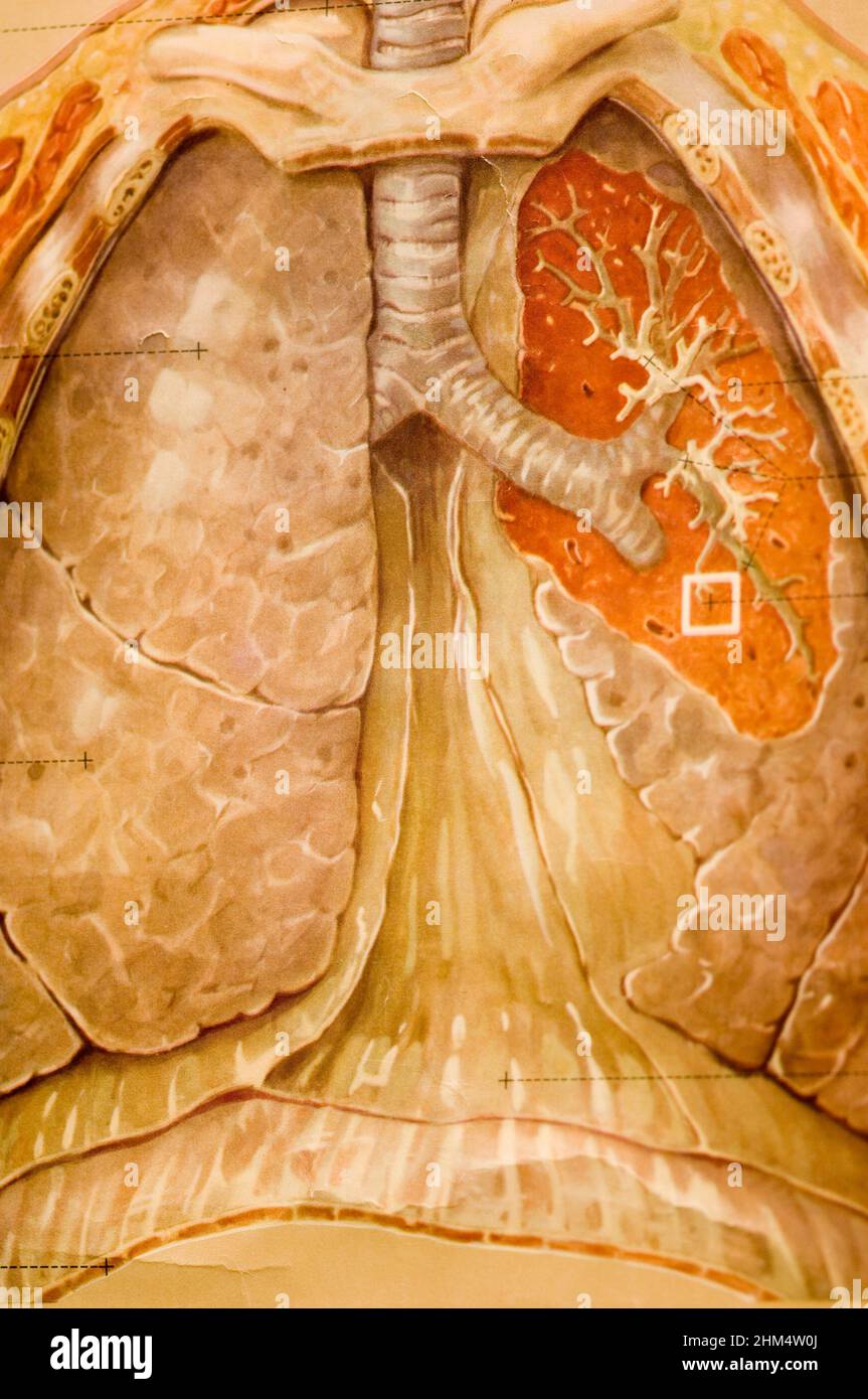 A Graphic Representation Of Human Lungs., Credit:Photoshot Creative / Stuart Cox / Avalon Stock Photo