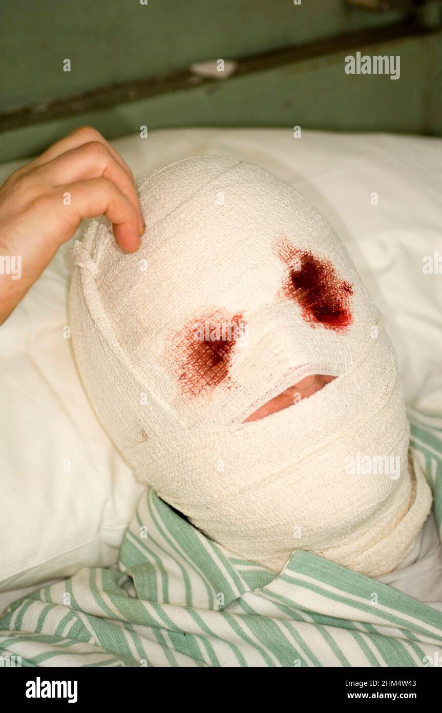 Image Of Patient With Fully Bandaged Head, In Bed Scratching Head., Credit:Photoshot Creative / Stuart Cox / Avalon Stock Photo