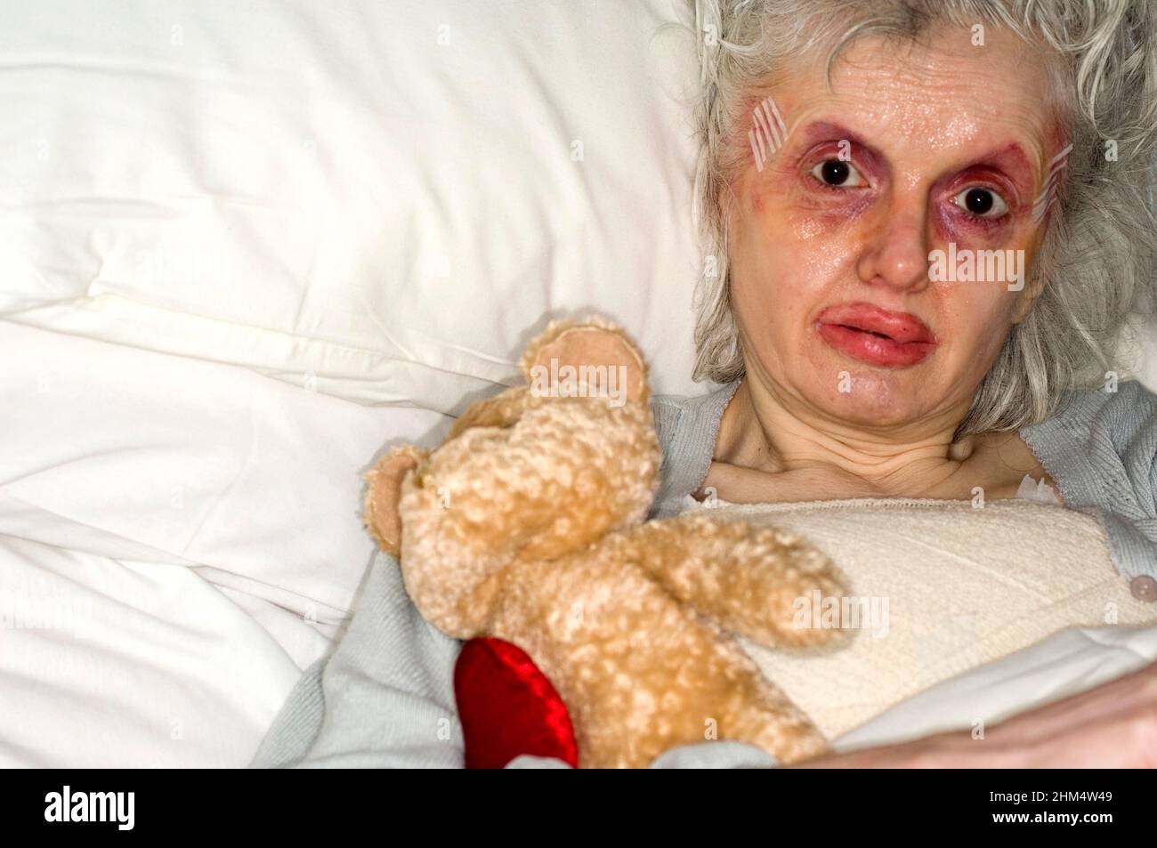 Old Patient In Bed With Teddy Bear, Head Shot, Looking To Camera., Credit:Photoshot Creative / Stuart Cox / Avalon Stock Photo