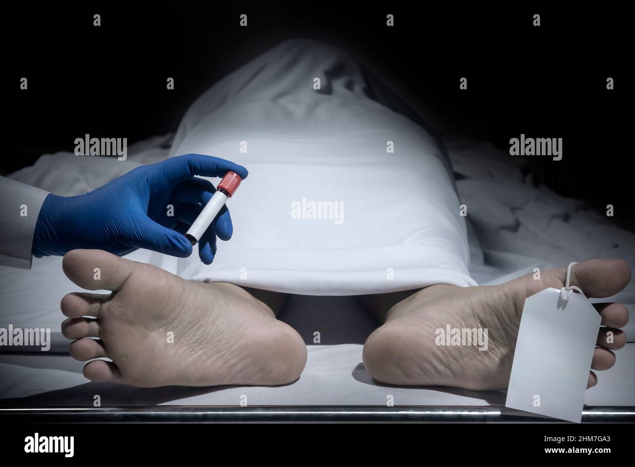 The nurse identify a blood sample of the human corpse covered with a
