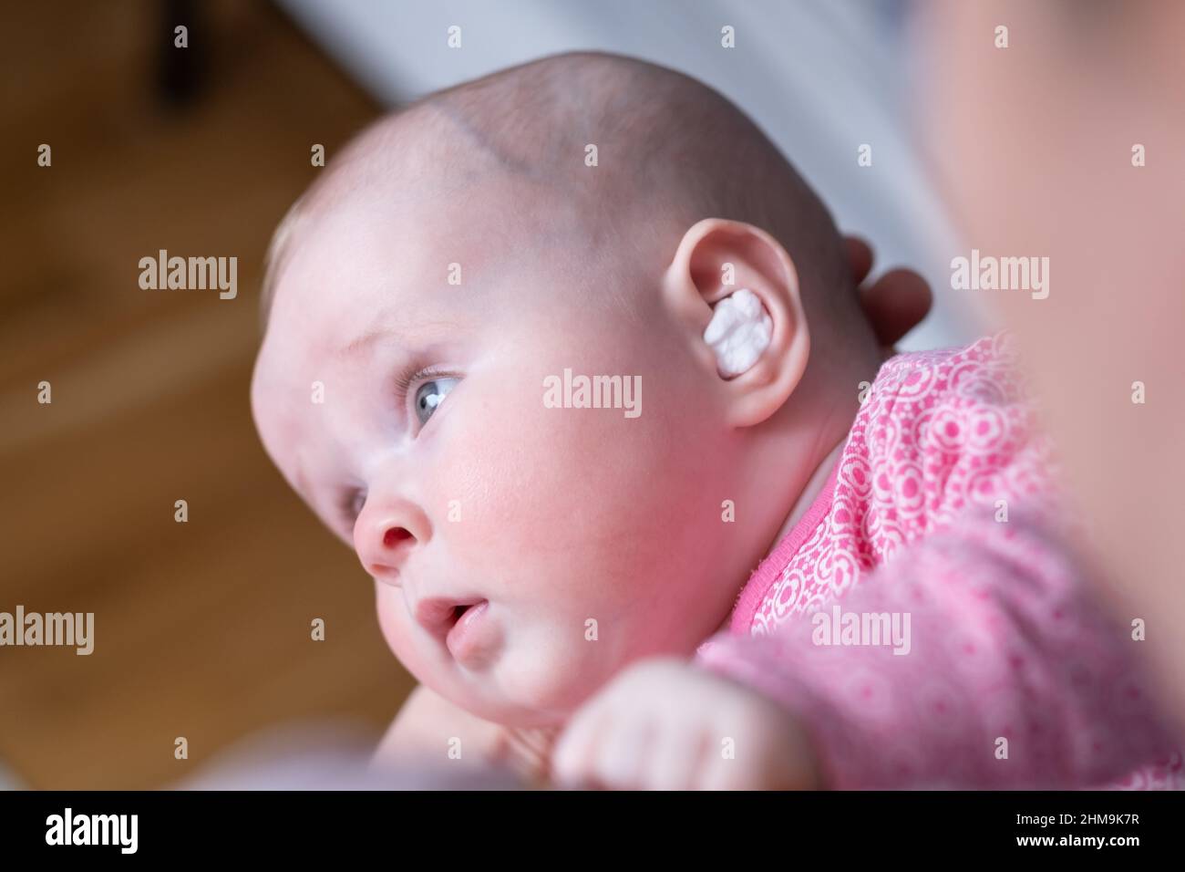 Caucasian baby with medication in ear. Infection treatment Stock Photo