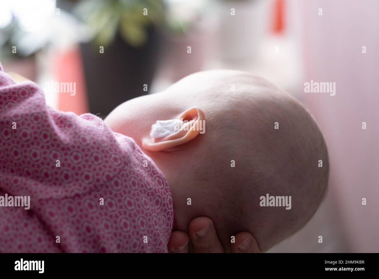 Caucasian baby with medication in ear. Infection treatment Stock Photo