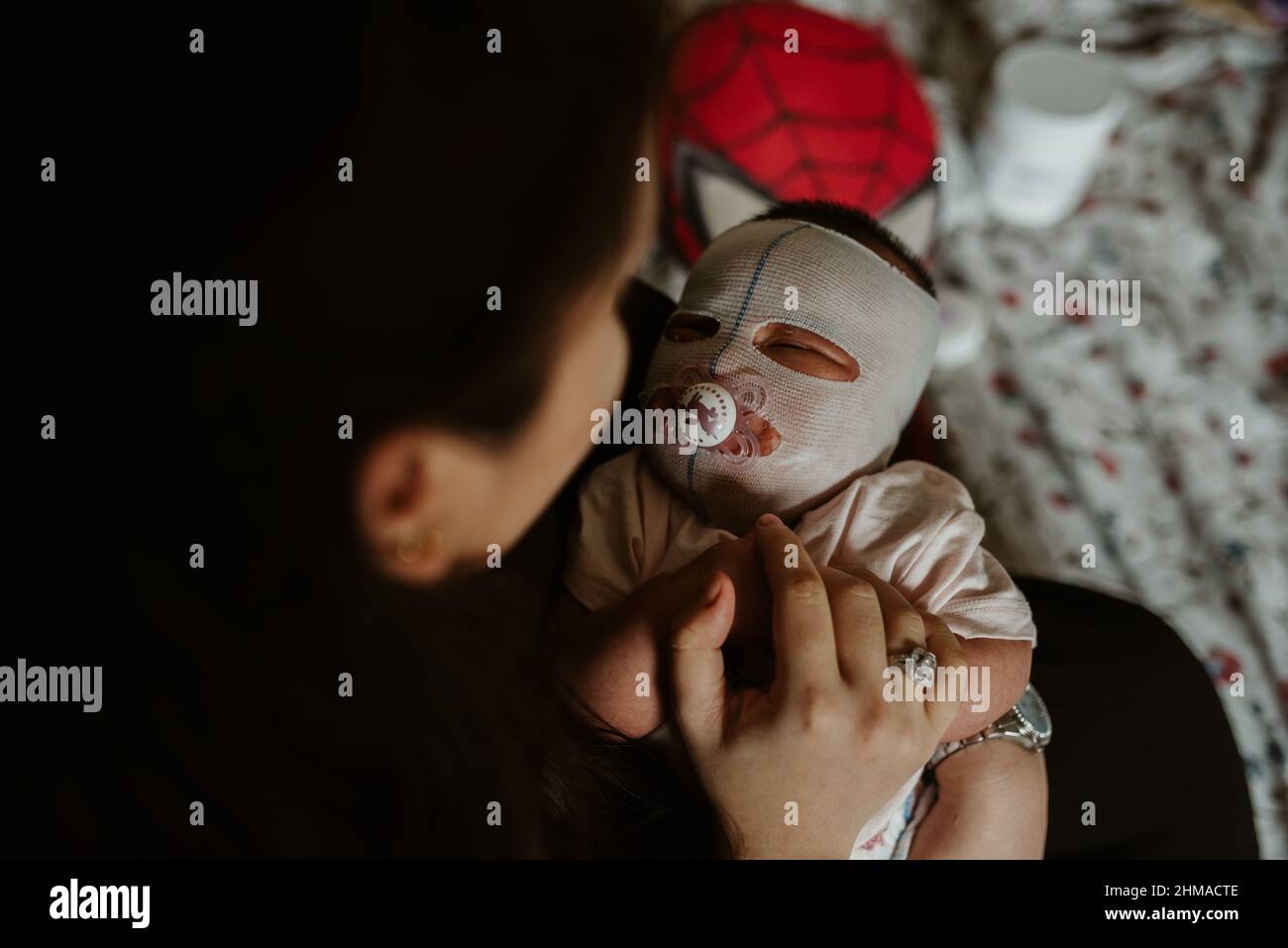 Mother looking at her newborn girl with eczema face mask Stock Photo