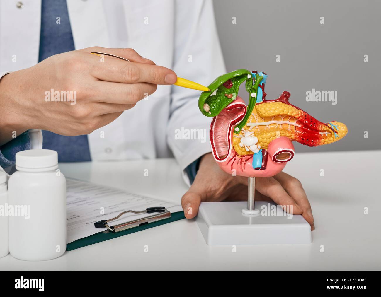 Treatment of gallbladder diseases and cholelithiasis. doctor demonstrations gallbladder on anatomical medical model for analysing and treatment gallbl Stock Photo