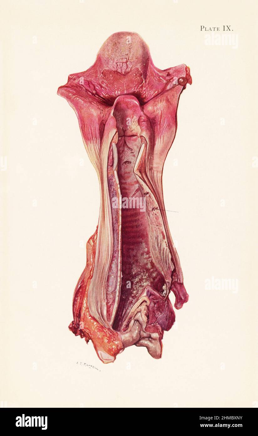 Ulceration of a trachea after mustard gas poisoning Stock Photo Alamy