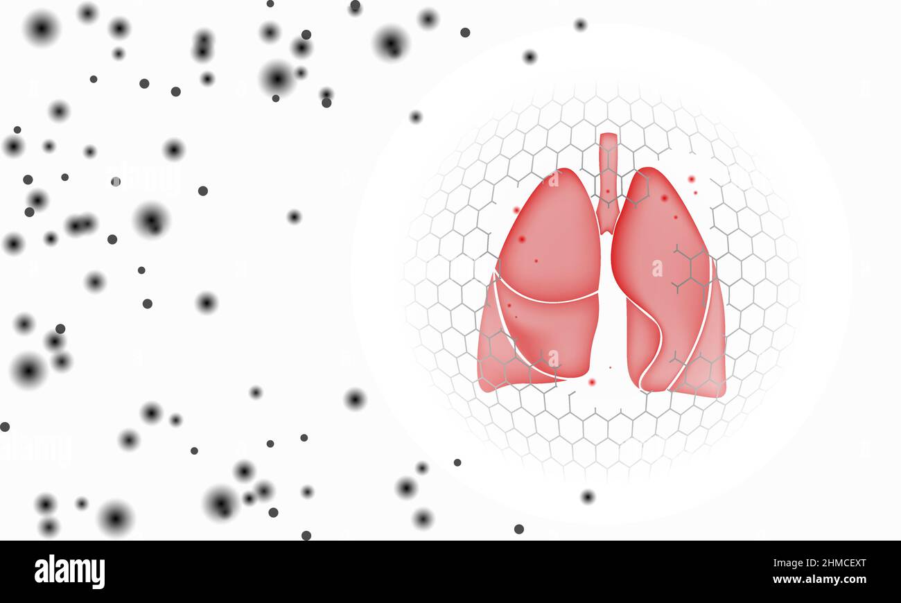 Lungs 3D hay rhinitis pollen reaction. Seasonal spring pollinosis sick atopic treatment concept. Drugstore allergy poster template online vector Stock Vector