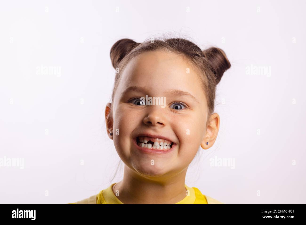 Close-up of shining little kid face showing missing front baby tooth and smiling crazily in yellow t-shirt on white background. First teeth changing Stock Photo