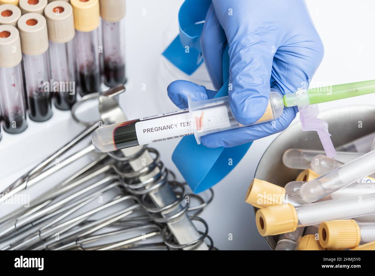 Scientists hand holding a testtube with blood sample for PREGNANCY