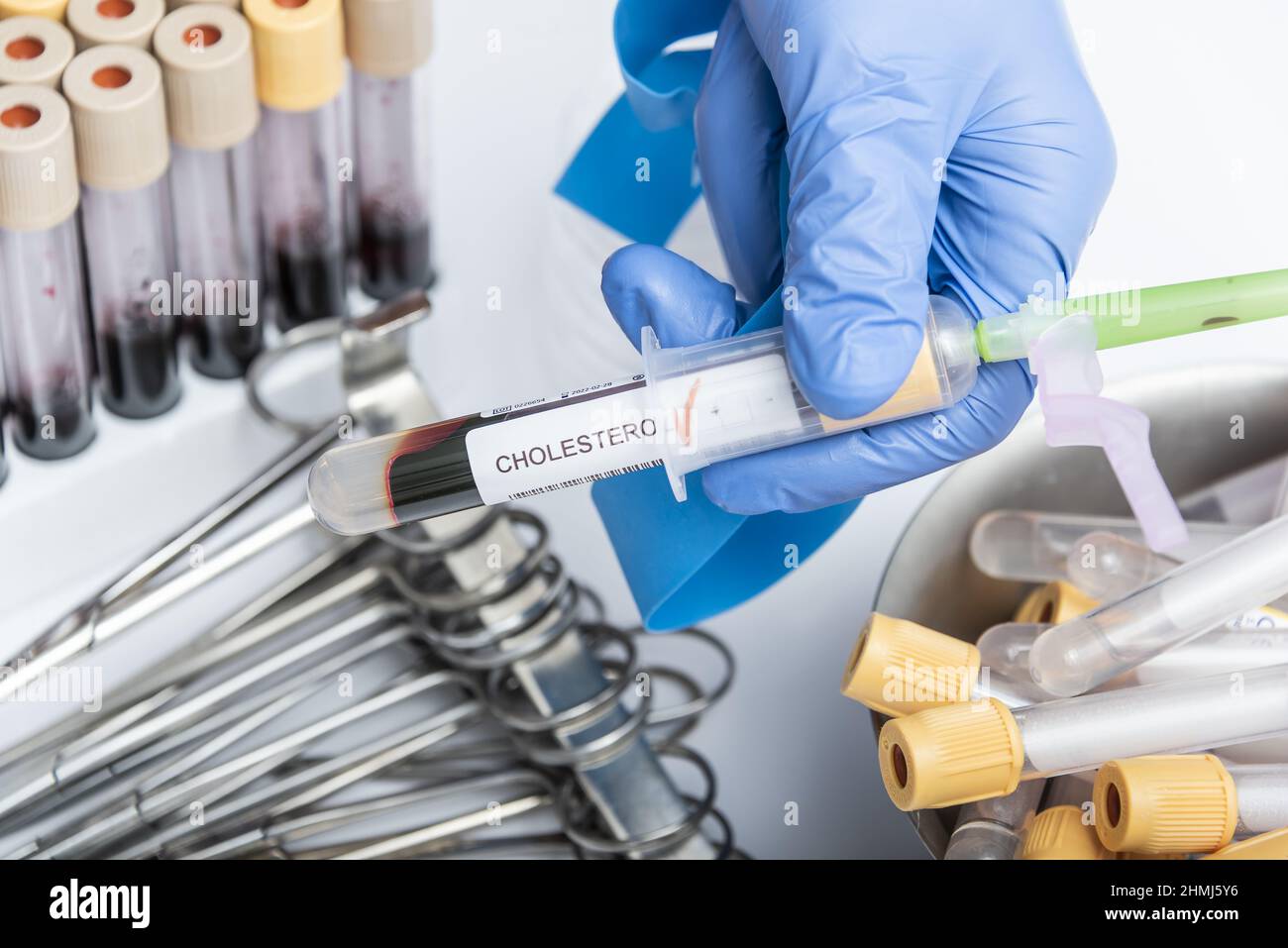 Test tube with blood sample for cholesterol test Stock Photo Alamy
