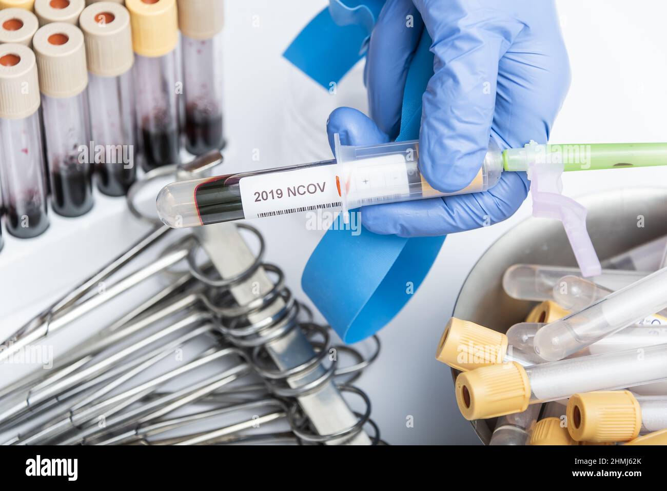 Scientists hand holding a test-tube with blood sample for NCOV19 test ...