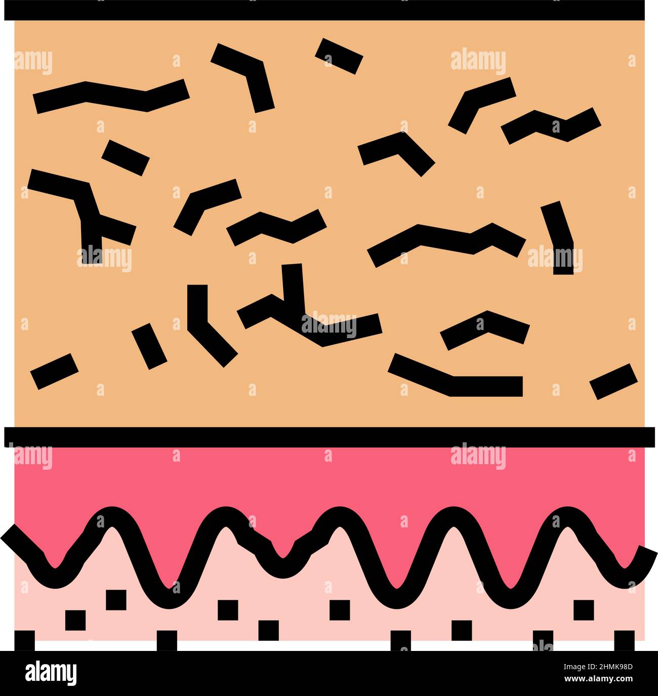 Dry scaly skin Stock Vector Images - Alamy