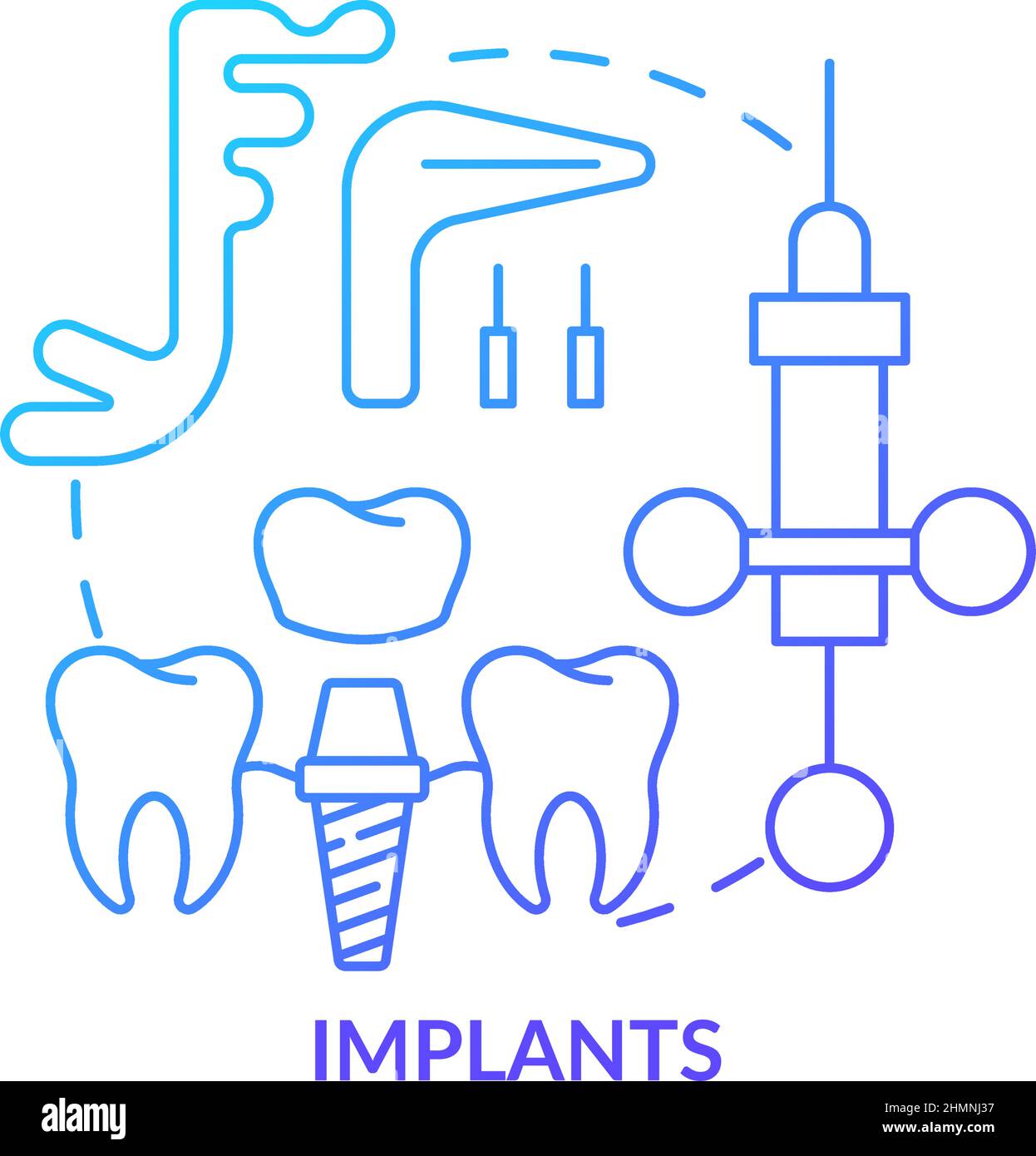 Implants blue gradient concept icon Stock Vector