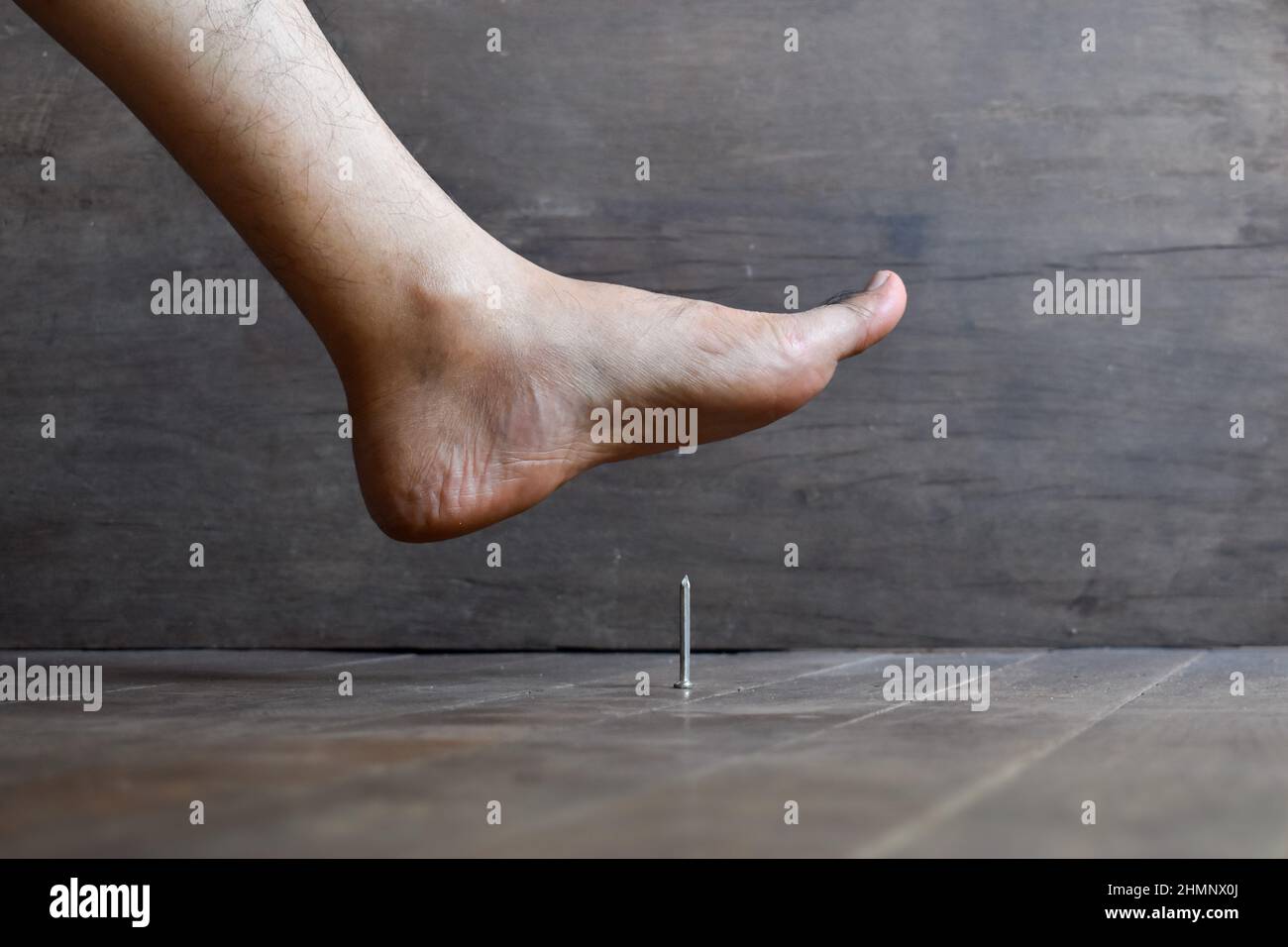 Nail prick injury in foot of Asian young man. Concept of tetanus Stock Photo Alamy