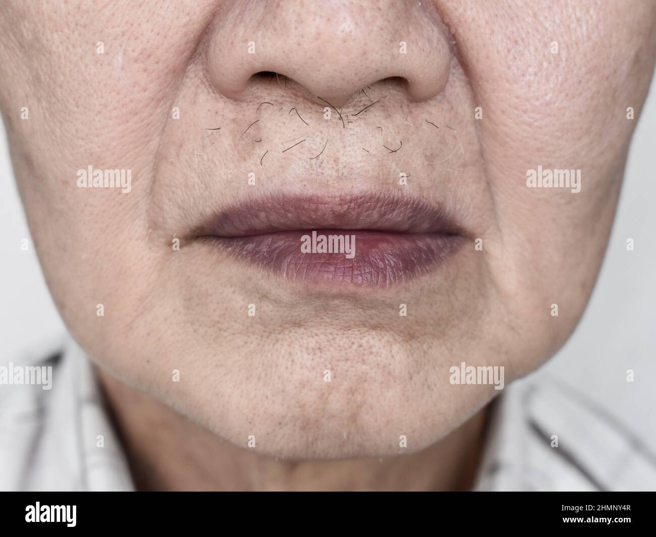 Discoloured lips hires stock photography and images Alamy