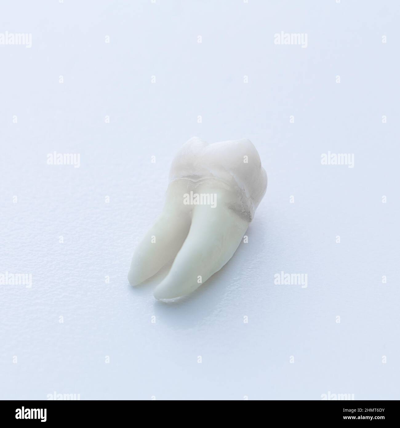wisdom tooth extraction dentist Stock Photo Alamy