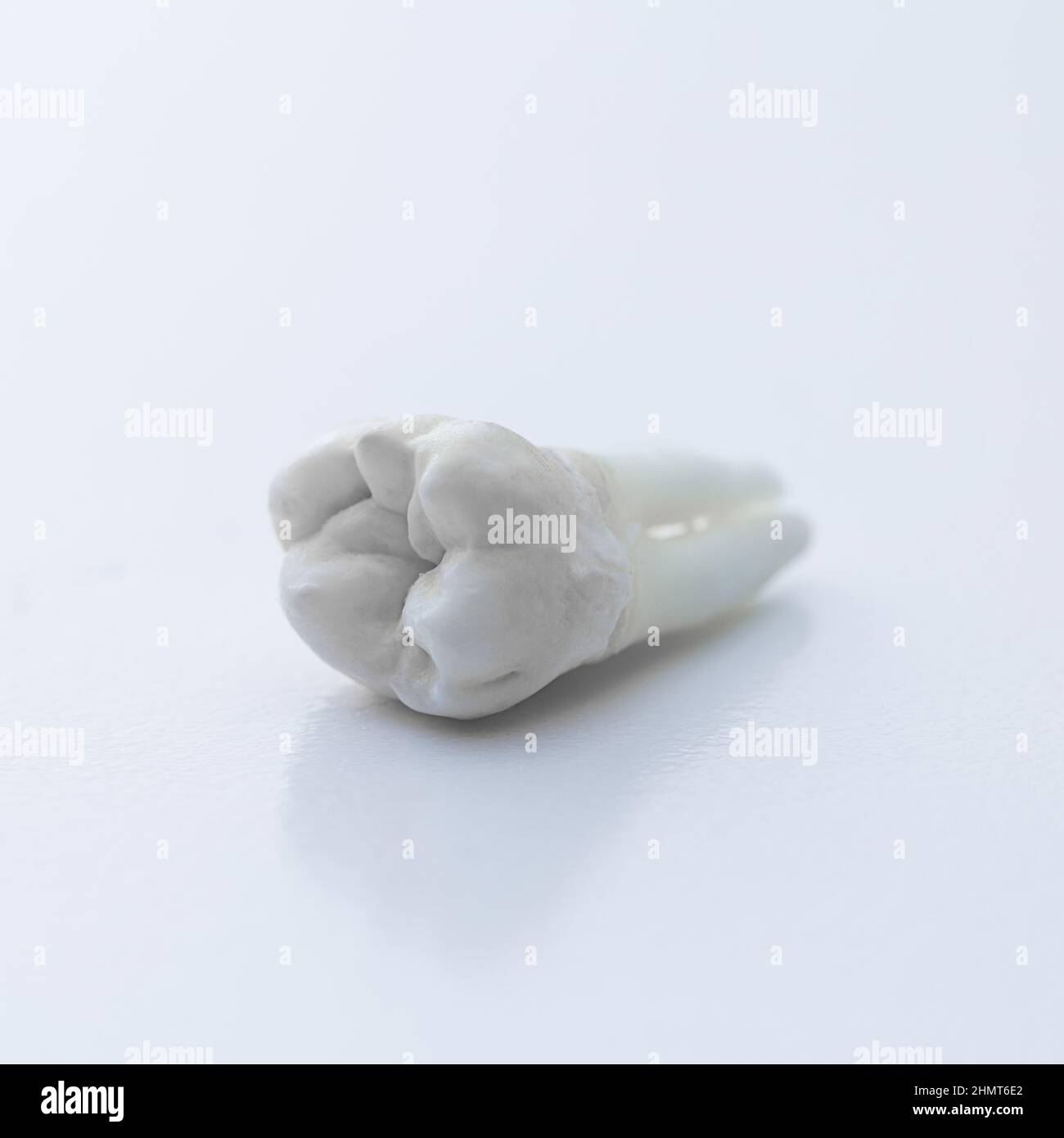 wisdom tooth extraction dentistry Stock Photo Alamy