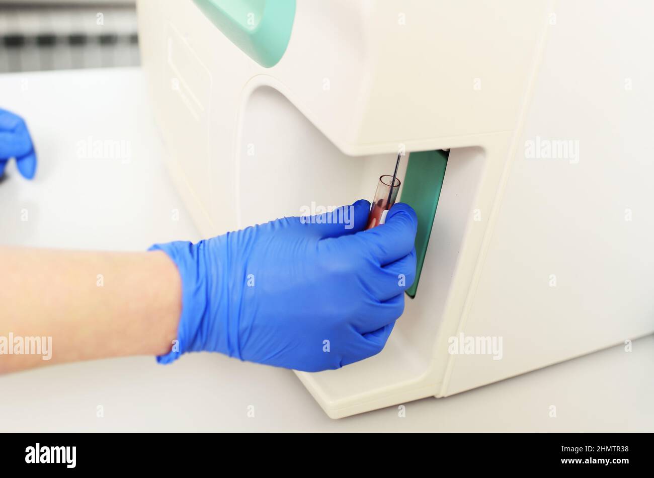a laboratory assistant examines a blood sample in an analyzer in a ...