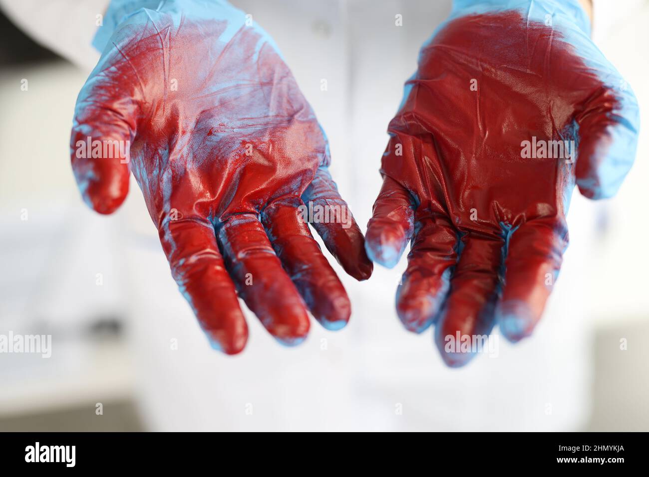 Doctor hands in rubber gloves with blood closeup Stock Photo Alamy