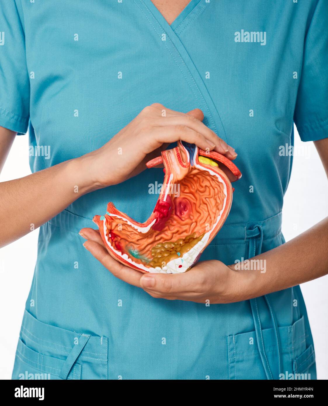 Diagnosis and treatment of stomach disease. doctor holding anatomical model of stomach with pathologies. Stomach health concept Stock Photo