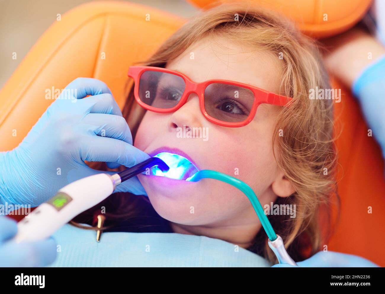 pediatric dentist seals the teeth of a little girl in a pediatric