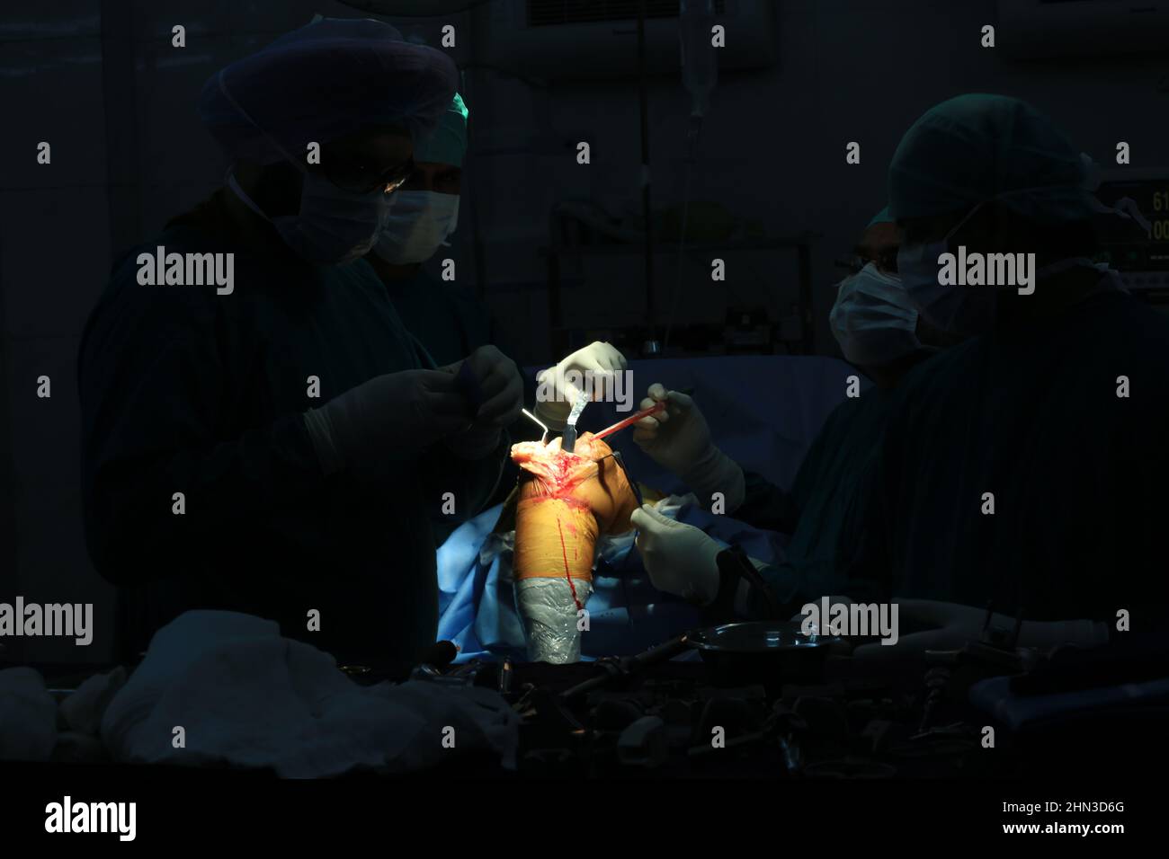 Knee replacement surgery in Operation theatre Stock Photo