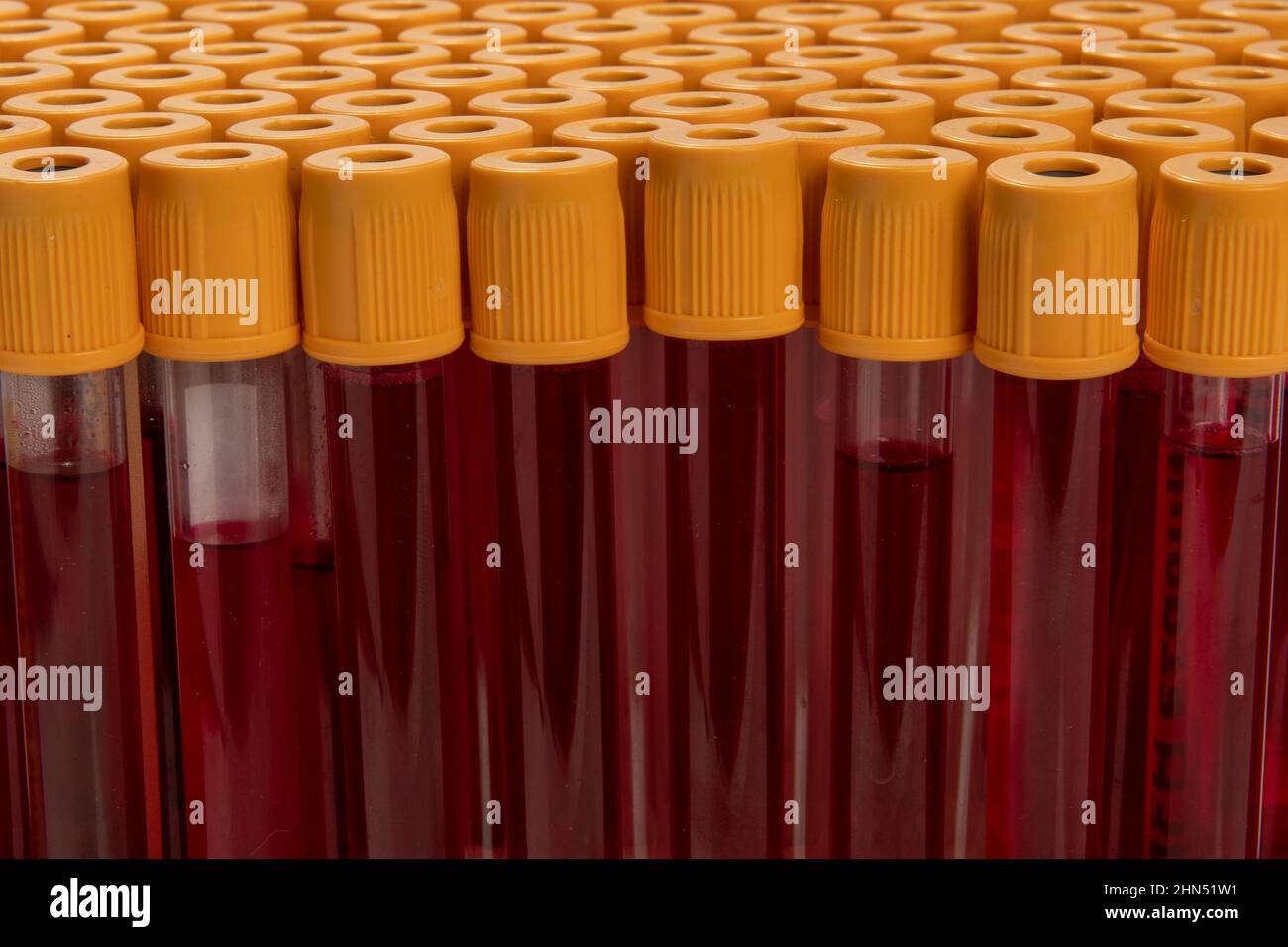 blood collection tube lined up, all ready for testing Stock Photo