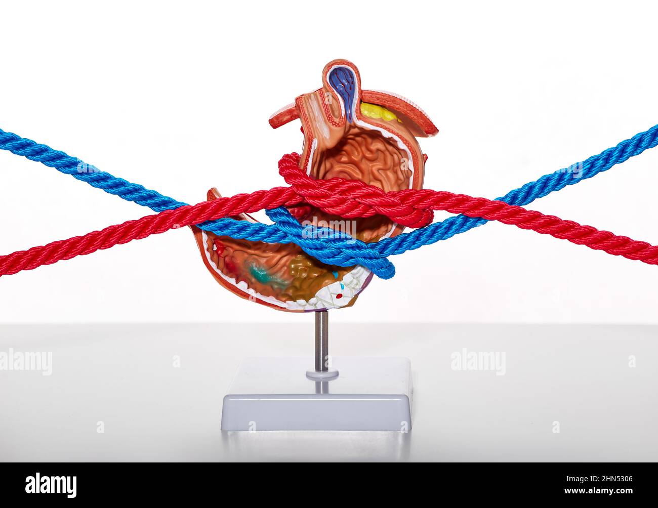 Problems and diseases of human stomach, tight stomach. Anatomical model of stomach tied with ropes simulating stomach compression and tight sensation Stock Photo