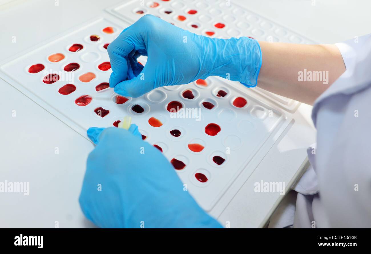 laboratory worker holds cuvette for definition of blood type and Rh
