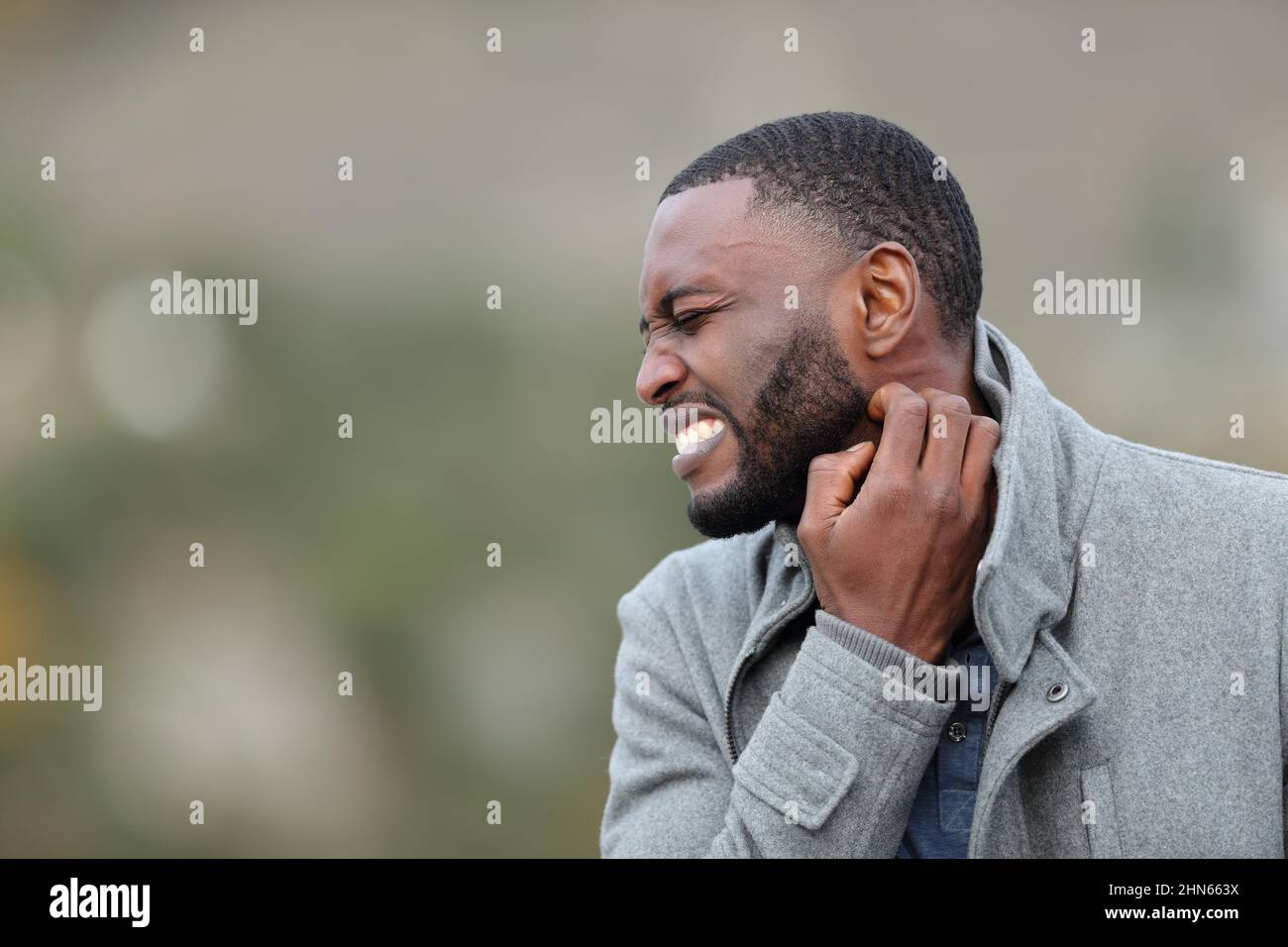 Stressed man with black skin scratching itchy neck in winter in a park Stock Photo