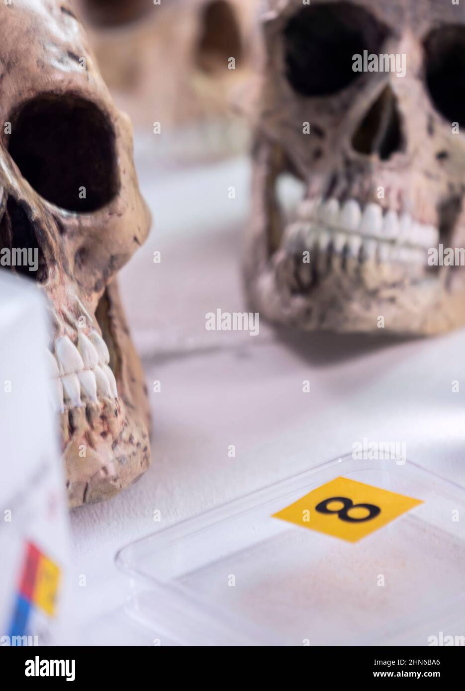 Several human skulls next to petri dish with bone remains to determine DNA in forensic laboratory Stock Photo