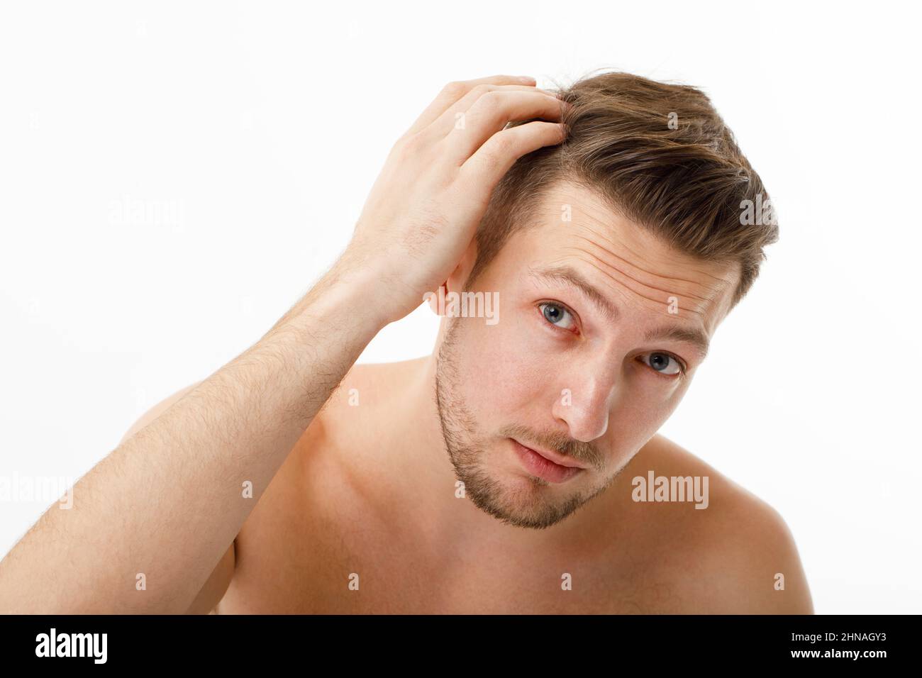 The young man was upset when he noticed his gray hair. Hair care, baldness graying. Stock Photo