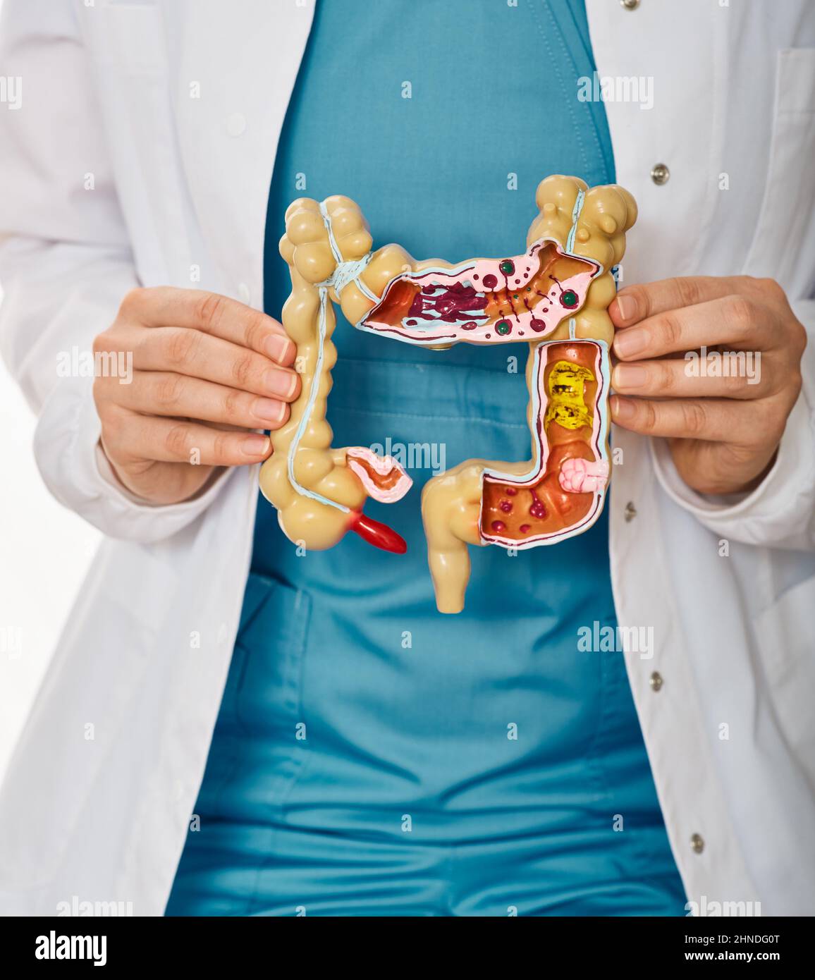 Treatment of colitis, flatulence, indigestion in healthcare. Anatomical intestines model with pathology in doctor hands, close-up Stock Photo