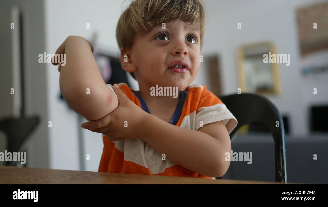 Kid showing mosquito bite child shows insect bite in arm Stock Photo Alamy