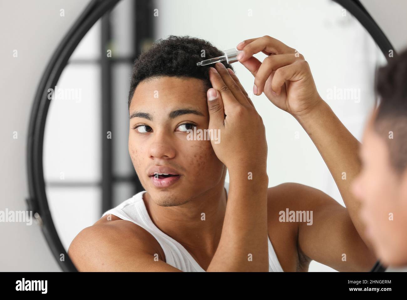 Young African American Guy Using Serum For Hair Growth In Bathroom